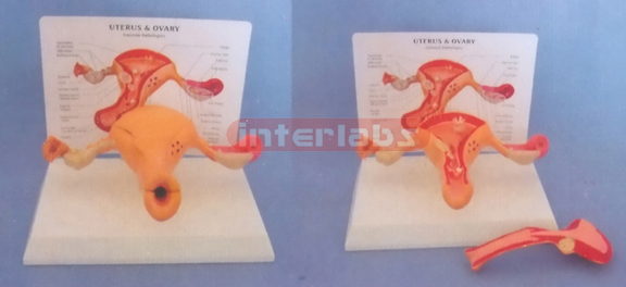 DESK TYPE, COMMON PATHOLOGIES UTERUS & OVARY WITH DESCRIPTION PLATE (2PCS) WITH COVER AND THE LESSER LIPS OF PUDENDUM